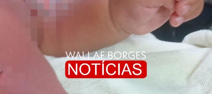 Bebê de 9 meses sofre queimaduras graves durante banho em CMEI de Sarandi e passa por cirurgia no HU de Maringá